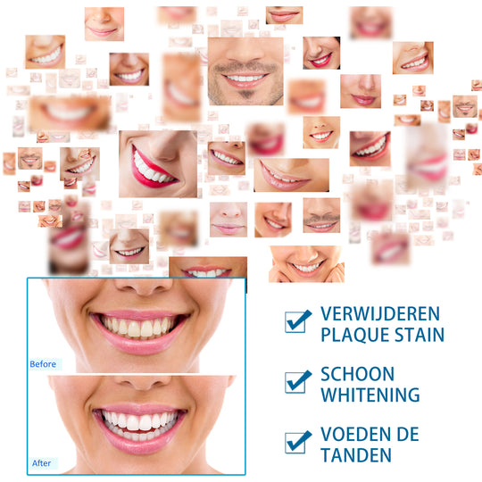 Teeth Whitening Pen